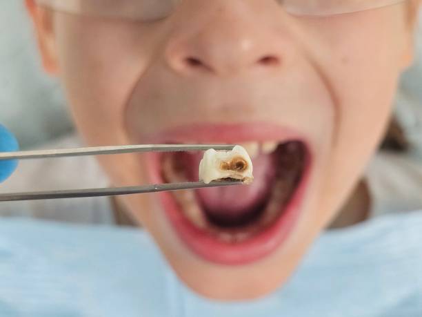 Best Emergency Denture Repair in Colwich, KS